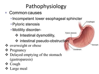 Comprehensive Overview of Esophageal Disorders and GERD Management | PDF