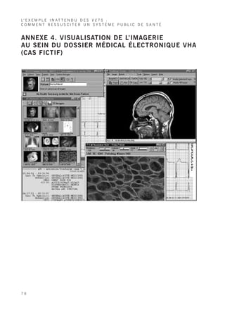 L’ E X E M P L E I N A T T E N D U D E S V E T S :
COMMENT RESSUSCITER UN SYSTÈME PUBLIC DE SANTÉ


ANNEXE 4. VISUALISATION DE L’IMAGERIE
AU SEIN DU DOSSIER MÉDICAL ÉLECTRONIQUE VHA
(CAS FICTIF)




78
 