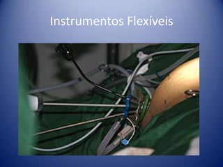 Instrumentos Flexíveis