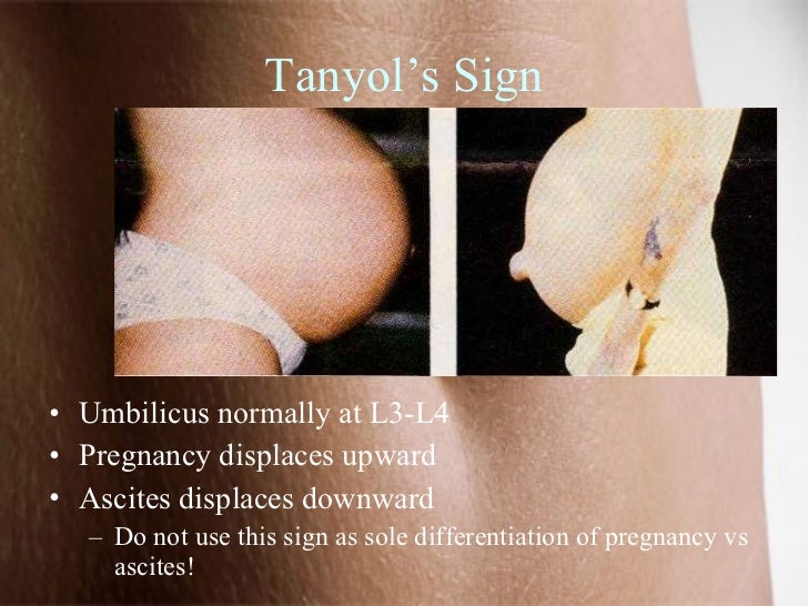 amniotic fluid vs discharge amniotic fluid vs discharge