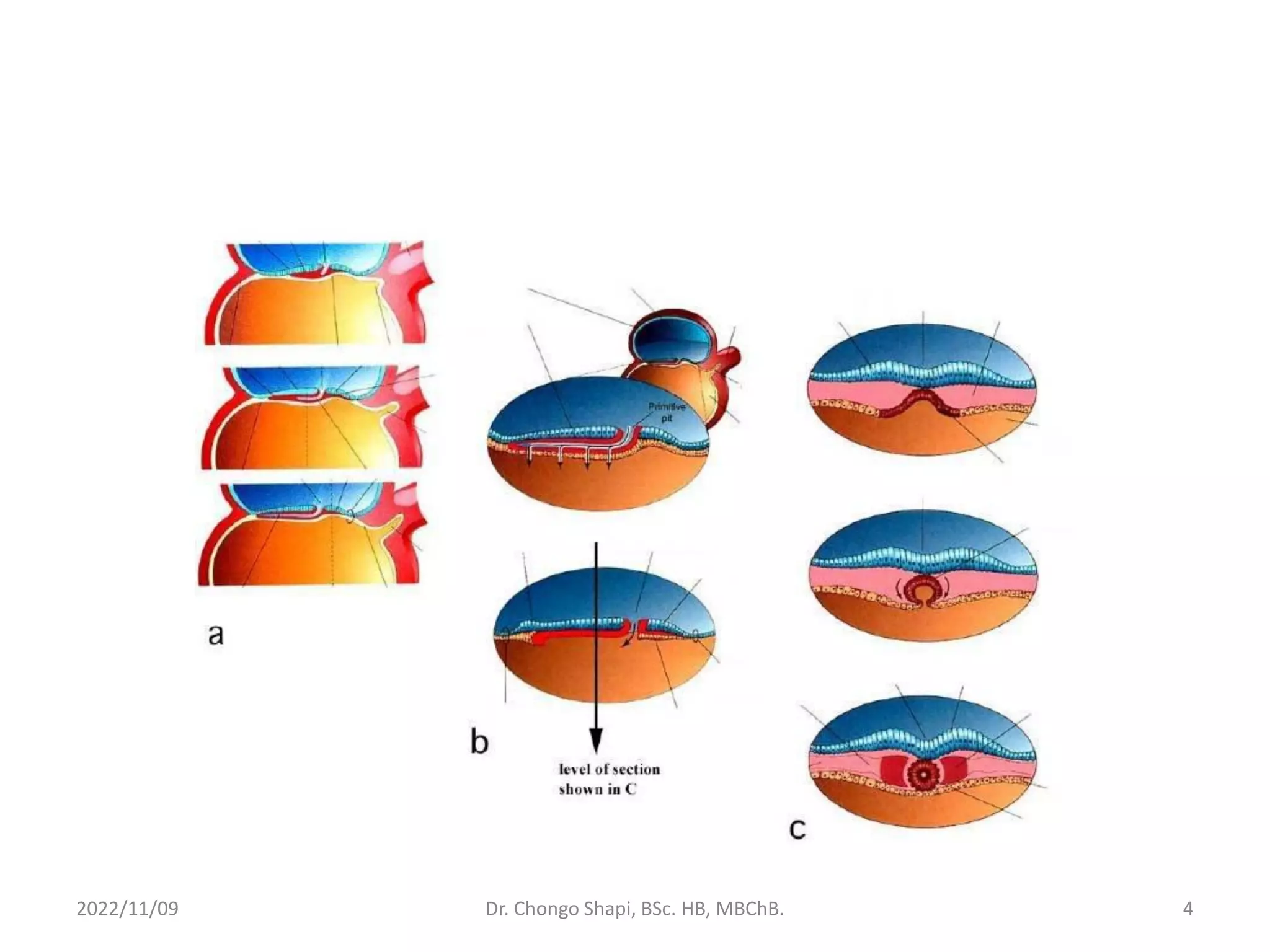 2022/11/09 Dr. Chongo Shapi, BSc. HB, MBChB. 4
 