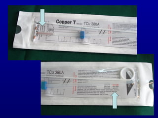 Inspection of Copper T
Expiry Date
 