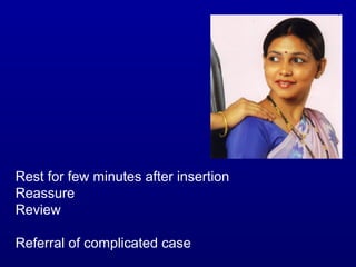Rest for few minutes after insertion
Reassure
Review

Referral of complicated case
 