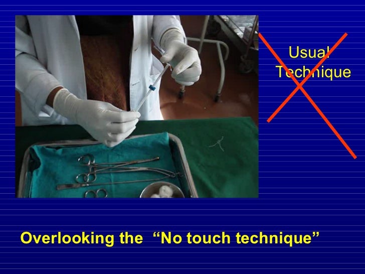 No touch loading technique