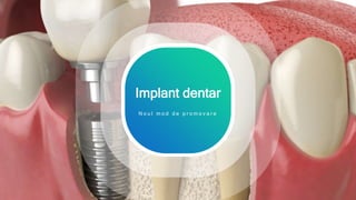 1
Implant dentar
N o u l m o d d e p r o m o v a r e
 