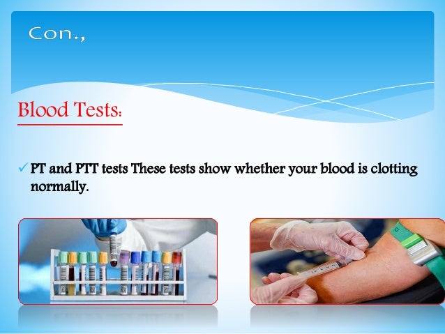 Why would your doctor order a PTT test?
