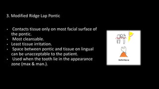 bridge and pontic design lecture | PPT