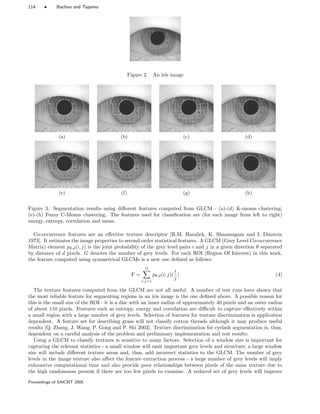 114 • Bachoo and Tapamo
Figure 2. An iris image
(a) (b) (c) (d)
(e) (f) (g) (h)
Figure 3. Segmentation results using diﬀerent features computed from GLCM - (a)-(d) K-means clustering;
(e)-(h) Fuzzy C-Means clustering. The features used for classiﬁcation are (for each image from left to right)
energy, entropy, correlation and mean.
Co-occurrence features are an eﬀective texture descriptor [R.M. Haralick, K. Shanmugam and I. Dinstein
1973]. It estimates the image properties to second-order statistical features. A GLCM (Grey Level Co-occurrence
Matrix) element pθ,d(i, j) is the joint probability of the grey level pairs i and j in a given direction θ separated
by distance of d pixels. G denotes the number of grey levels. For each ROI (Region Of Interest) in this work,
the feature computed using symmetrical GLCMs is a new one deﬁned as follows:
F =
G
i,j=1
pθ,d(i, j)(
i
j
) (4)
The texture features computed from the GLCM are not all useful. A number of test runs have shown that
the most reliable feature for segmenting regions in an iris image is the one deﬁned above. A possible reason for
this is the small size of the ROI - it is a disc with an inner radius of approximately 40 pixels and an outer radius
of about 110 pixels. Features such as entropy, energy and correlation are diﬃcult to capture eﬀectively within
a small region with a large number of grey levels. Selection of features for texture discrimination is application
dependent. A feature set for describing grass will not classify cotton threads although it may produce useful
results [Q. Zhang, J. Wang, P. Gong and P. Shi 2003]. Texture discrimination for eyelash segmentation is, thus,
dependent on a careful analysis of the problem and preliminary implementation and test results.
Using a GLCM to classify textures is sensitive to many factors. Selection of a window size is important for
capturing the relevant statistics - a small window will omit important grey levels and structure; a large window
size will include diﬀerent texture areas and, thus, add incorrect statistics to the GLCM. The number of grey
levels in the image texture also aﬀect the feature extraction process - a large number of grey levels will imply
exhaustive computational time and also provide poor relationships between pixels of the same texture due to
the high randomness present if there are too few pixels to examine. A reduced set of grey levels will improve
Proceedings of SAICSIT 2005
 