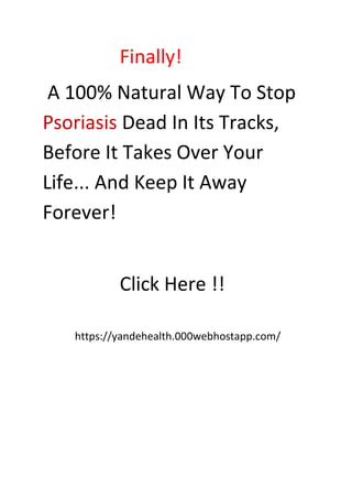 Finally!
A 100% Natural Way To Stop
Psoriasis Dead In Its Tracks,
Before It Takes Over Your
Life... And Keep It Away
Forever!
Click Here !!
https://yandehealth.000webhostapp.com/
 