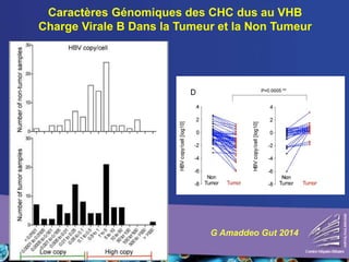 Caractères Génomiques des CHC dus au VHB
Charge Virale B Dans la Tumeur et la Non Tumeur
G Amaddeo Gut 2014
 