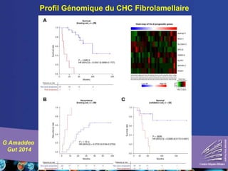 Profil Génomique du CHC Fibrolamellaire
G Amaddeo
Gut 2014
 