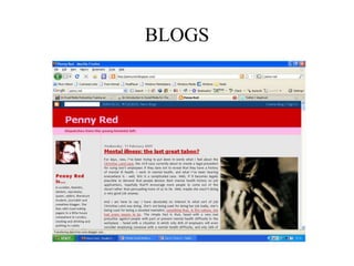 BLOGS