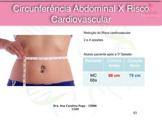 Dra. Ana Carolina Puga – CRBM:
5589
Redução do Risco cardiovascular
2 a 4 sessões
Abaixo paciente após a 3a Sessão
Paciente Cintura
Antes
Cintura
Após
MC
68a
88 cm 79 cm
Circunferência Abdominal X Risco
Cardiovascular
53
 