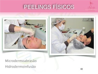 Microdermoabrasão
Hidrodermoinfusão
PEELINGS FÍSICOS
60
 