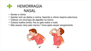 HEMORRAGIA
NASAL
• Sentar a vítima
• Apertar com os dedos a narina, fazendo a vítima respirar pela boca
• Colocar um chumaço de algodão na narina
• Colocar toalha úmida, fria ou gelo sobre o rosto
• Não assoar nariz pelo menos 1 hora após cessar sangramento
 