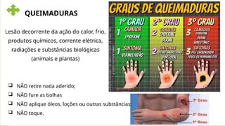 QUEIMADURAS
Lesão decorrente da ação do calor, frio,
produtos químicos, corrente elétrica,
radiações e substâncias biológicas
(animais e plantas)
 NÃO retire nada aderido;
 NÃO fure as bolhas
 NÃO aplique óleos, loções ou outras substâncias;
 NÃO toque.
 
