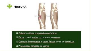 QUEIMADURAS
FRATURA
 