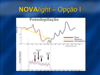 NOVAlight – Opção I
 