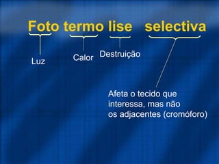 Foto termo lise selectiva
Luz Calor Destruição
Afeta o tecido que
interessa, mas não
os adjacentes (cromóforo)
 