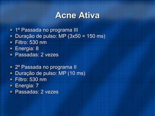 Acne Ativa
1º Passada no programa III
Duração de pulso: MP (3x50 = 150 ms)
Filtro: 530 nm
Energia: 8
Passadas: 2 vezes
2º Passada no programa II
Duração de pulso: MP (10 ms)
Filtro: 530 nm
Energia: 7
Passadas: 2 vezes
 