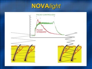 NOVAlight
 