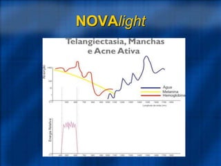 NOVAlight
 