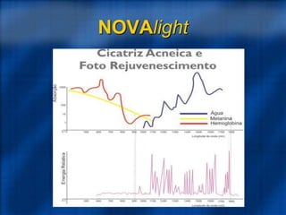 NOVAlight
 