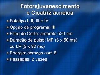 Fotorejuvenescimento
e Cicatriz acneica
Fototipo I, II, III e IV
Opção de programa: III
Filtro de Corte: amarelo 530 nm
Duração de pulso: MP (3 x 50 ms)
ou LP (3 x 90 ms)
Energia: começa com 8
Passadas: 2 vezes
 