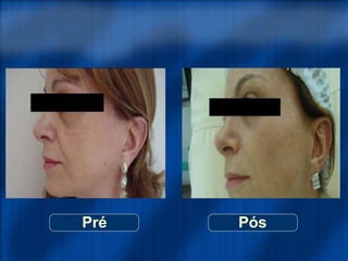 Pré Pós
 