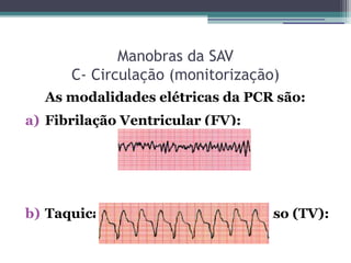 Manobras da SAV
      C- Circulação (monitorização)
  As modalidades elétricas da PCR são:
a) Fibrilação Ventricular (FV):




b) Taquicardia Ventricular sem Pulso (TV):
 
