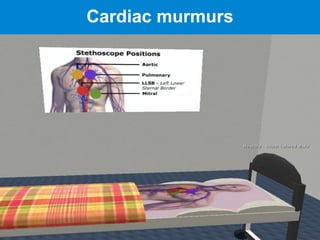 Cardiac murmurs
 
