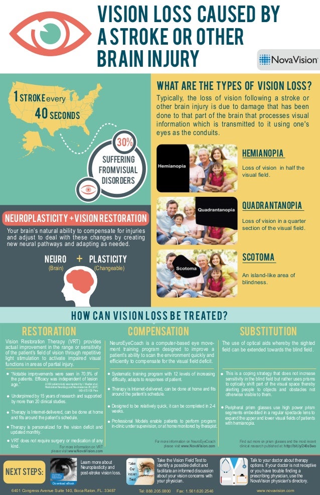 Vision Loss Caused By A Stroke Or Other Brain Injury