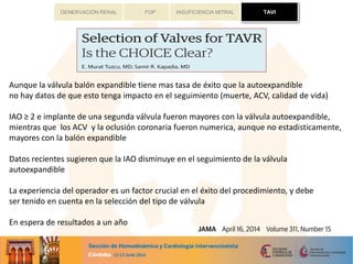TAVIFOP INSUFICIENCIA MITRALDENERVACIÓN RENAL
Aunque la válvula balón expandible tiene mas tasa de éxito que la autoexpandible
no hay datos de que esto tenga impacto en el seguimiento (muerte, ACV, calidad de vida)
IAO ≥ 2 e implante de una segunda válvula fueron mayores con la válvula autoexpandible,
mientras que los ACV y la oclusión coronaria fueron numerica, aunque no estadisticamente,
mayores con la balón expandible
Datos recientes sugieren que la IAO disminuye en el seguimiento de la válvula
autoexpandible
La experiencia del operador es un factor crucial en el éxito del procedimiento, y debe
ser tenido en cuenta en la selección del tipo de válvula
En espera de resultados a un año
TAVI
 