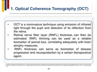 84
1. Optical Coherence Tomography (OCT)
E. Grazioli, R. Zivadinov, B. Weinstock-Guttman et al., “Retinal nerve fiber layer thickness is associated with brain MRI outcomes in multiple sclerosis,” Journal of the Neurological Sciences, vol. 268, no. 1-2, pp. 12–17, 2008.
R. Herrero, E. Garcia-Martin, C. Almarcegui, et al., “Progressive degeneration of the retinal nerve fiber layer in patients with multiple sclerosis,” Investigative Ophthalmology & Visual Science, vol. 53, no. 13, pp. 8344–8349,
2012.
• OCT is a noninvasive technique using emission of infrared
light through the pupil and detection of its reflection from
the retina.
• Retinal nerve fiber layer (RNFL) thickness can then be
estimated. RNFL thinning can be used as a reliable
biomarker of axonal loss, correlating adequately with brain
atrophy measures.
• RNFL thickness can serve as biomarker of disease
progression and neuroprotection by a certain therapeutical
agent.
 