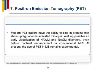 99
7. Positron Emission Tomography (PET)
• Modern PET tracers have the ability to bind in proteins that
show upregulation in activated microglia, making possible an
early visualization of NAWM and NAGM disorders, even
before contrast enhancement in conventional MRI. At
present, the use of PET in MS remains experimental.
U. Oh, M. Fujita, V. N. Ikonomidou et al., “Translocator protein PET imaging for glial activation in multiple sclerosis,” Journal of Neuroimmune Pharmacology, vol. 6, no. 3, pp. 354–361, 2011.
 