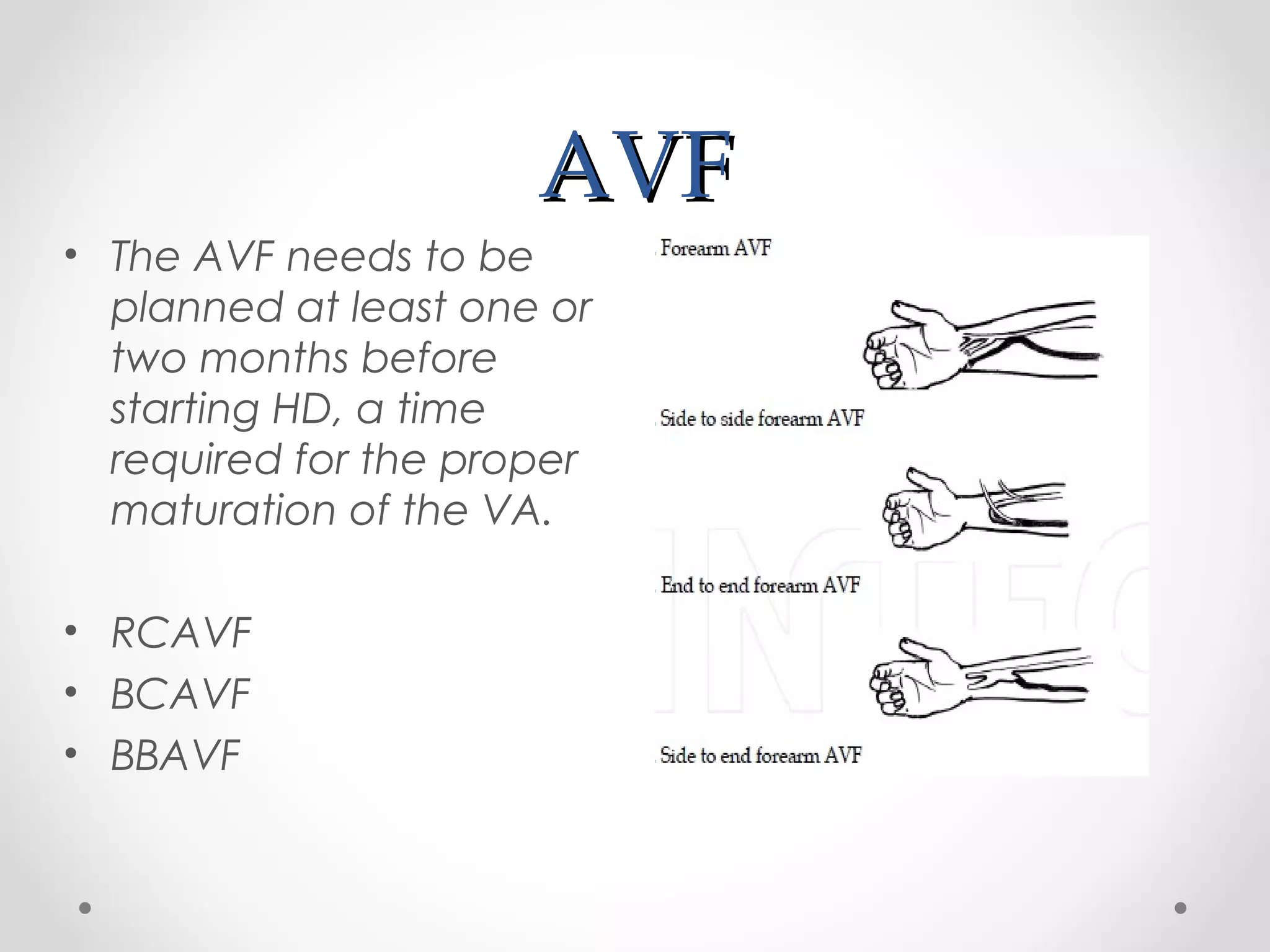 Novel trends in hemodialysis vascular access | PPT