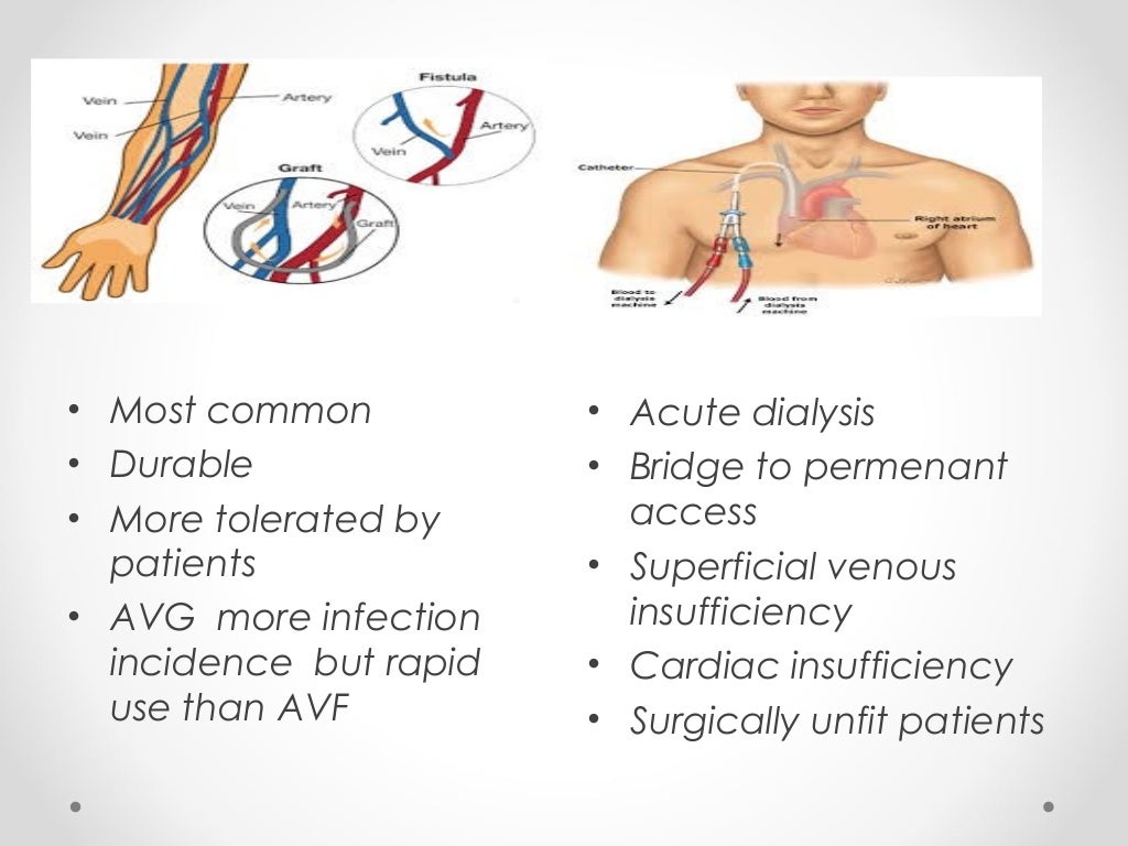 Novel trends in hemodialysis vascular access