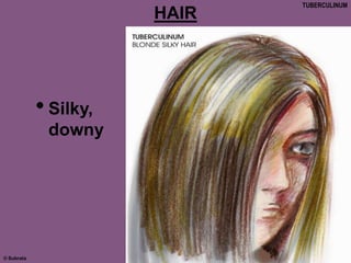 © Subrata
HAIR
•Silky,
downy
TUBERCULINUM
 