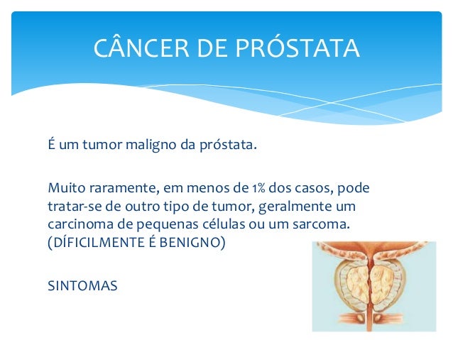 Cancer De Prostata Novembro Azul Ppt Novembro Azul