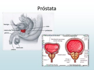 Próstata
 