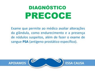 APOIAMOS ESSA CAUSA
DIAGNÓSTICO
PRECOCE
Exame que permite ao médico avaliar alterações
da glândula, como endurecimento e a presença
de nódulos suspeitos, além de fazer o exame de
sangue PSA (antígeno prostático específico).
 