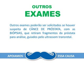 APOIAMOS ESSA CAUSA
OUTROS
EXAMES
Outros exames poderão ser solicitados se houver
suspeita de CÂNCE DE PRÓSTATA, com as
BIÓPSIAS, que retiram fragmentos da próstata
para análise, guiados pelo ultrassom transretal.
 