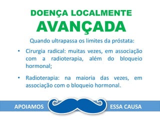 APOIAMOS ESSA CAUSA
Quando ultrapassa os limites da próstata:
• Cirurgia radical: muitas vezes, em associação
com a radioterapia, além do bloqueio
hormonal;
DOENÇA LOCALMENTE
AVANÇADA
• Radioterapia: na maioria das vezes, em
associação com o bloqueio hormonal.
 