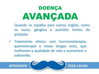 APOIAMOS ESSA CAUSA
Quando se espalha para outros órgãos, como
os ossos, gânglios e pulmões limites da
próstata:
DOENÇA
AVANÇADA
• Tratamento clínico: com hormonioterapia,
quimioterapia e novas drogas orais, que
melhoram a qualidade de vida e aumentam a
sobrevida;
 