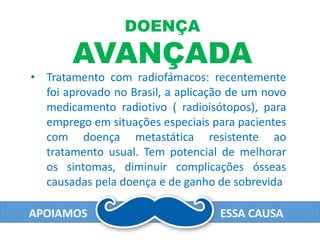 APOIAMOS ESSA CAUSA
DOENÇA
AVANÇADA
• Tratamento com radiofámacos: recentemente
foi aprovado no Brasil, a aplicação de um novo
medicamento radiotivo ( radioisótopos), para
emprego em situações especiais para pacientes
com doença metastática resistente ao
tratamento usual. Tem potencial de melhorar
os sintomas, diminuir complicações ósseas
causadas pela doença e de ganho de sobrevida
 