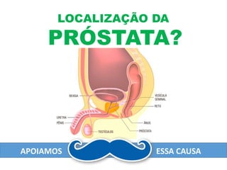LOCALIZAÇÃO DA
PRÓSTATA?
APOIAMOS ESSA CAUSA
 