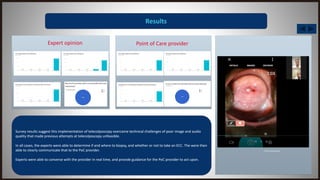 Results
Survey results suggest this implementation of telecolposcopy overcame technical challenges of poor image and audio
quality that made previous attempts at telecolposcopy unfeasible.
In all cases, the experts were able to determine if and where to biopsy, and whether or not to take an ECC. The were then
able to clearly communicate that to the PoC provider.
Experts were able to converse with the provider in real time, and provide guidance for the PoC provider to act upon.
Expert opinion Point of Care provider
Click to play video
 