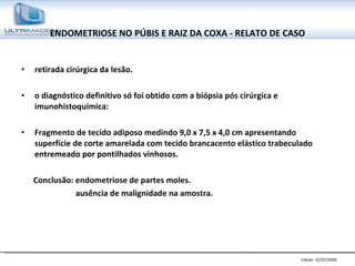 ENDOMETRIOSE NO PÚBIS E RAIZ DA COXA - RELATO DE CASO retirada cirúrgica da lesão. o diagnóstico definitivo só foi obtido com a biópsia pós cirúrgica e imunohistoquímica: Fragmento de tecido adiposo medindo 9,0 x 7,5 x 4,0 cm apresentando superfície de corte amarelada com tecido brancacento elástico trabeculado entremeado por pontilhados vinhosos. Conclusão: endometriose de partes moles. ausência de malignidade na amostra. 
