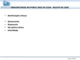 ENDOMETRIOSE NO PÚBIS E RAIZ DA COXA - RELATO DE CASO Manifestações clínicas: Dismenorréia  Dispareunia  Dor pélvica crônica Infertilidade   