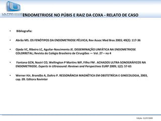 ENDOMETRIOSE NO PÚBIS E RAIZ DA COXA - RELATO DE CASO Bibliografia: Abrão MS. OS FENÓTIPOS DA ENDOMETRIOSE PÉLVICA; Rev Assoc Med Bras 2003; 49(2): 117-36 Ojeda VC, Ribeiro LC, Aguilar-Nascimento JE. DISSEMINAÇÃO LINFÁTICA NA ENDOMETRIOSE COLORRETAL; Revista do Colégio Brasileiro de Cirurgiões — Vol. 27 – no 4 Fontana GCN, Nastri CO, Wellington P Martins WP, Filho FM . ACHADOS ULTRA-SONOGRÁFICOS NA ENDOMETRIOSE.  Experts in Ultrasound: Reviews and Perspectives  EURP 2009; 1(2): 57-65 Werner HJr, Brandão A, Daltro P. RESSONÂNCIA MAGNÉTICA EM OBSTETRÍCIA E GINECOLOGIA, 2003, cap. 09. Editora Revinter 